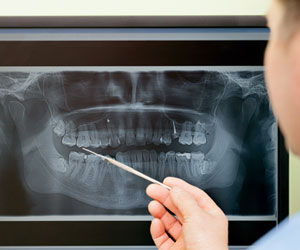 digital-dental-lab-denver-co